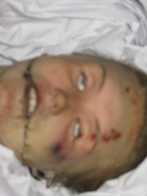 layne staley autopsy photo | Diigo Groups